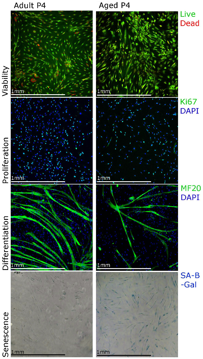 Microscopy images; cell viability, proliferation, differentiation, senescence in adult vs. aged samples.