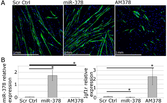 Fluorescence microscopy of miR-378 expression, cytoskeleton staining; bar chart of relative expression.