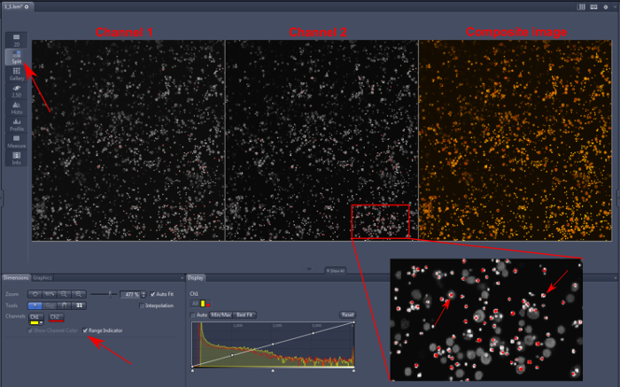 Fluorescence microscopy analysis: dual-channel imaging, composite reconstruction, particle quantification.