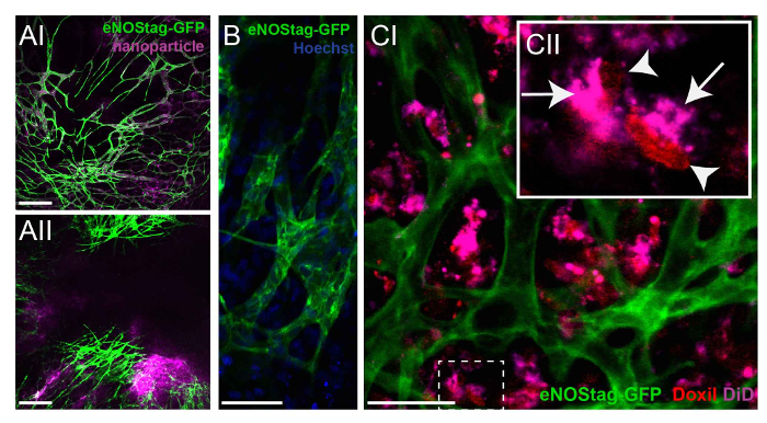 Fluorescent microscopy of eNOS-GFP and nanoparticles in cells; shows cell structure and interaction.
