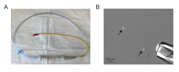 figure-results-1 Catheter setup and microscope image; equipment, particle visualization, medical application.