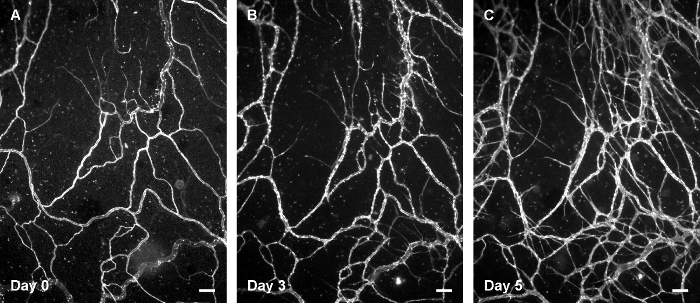 Neuronal network growth, microscope images, Day 0-5 progression, neurodevelopment study.