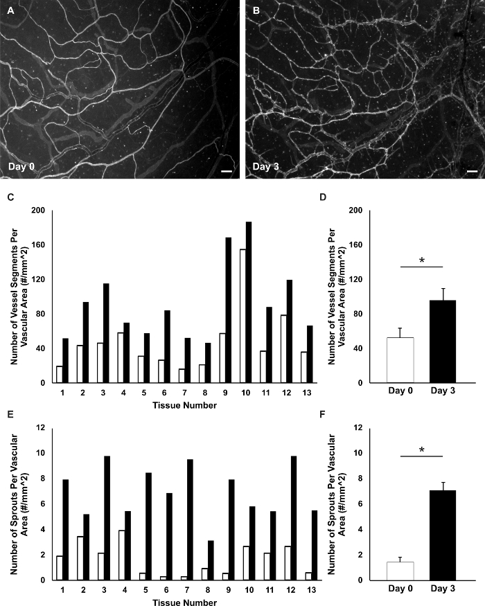 Angiogenesis process; vessel growth over time; microscopic images; bar graphs; vascular analysis.