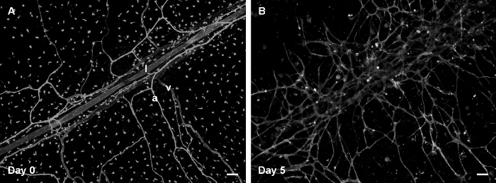 Neuronal network growth over 5 days, fluorescence microscopy, cellular structure analysis, time-lapse study.