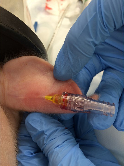 Blood sample collection, needle insertion, medical procedure, vein puncture, clinical analysis.