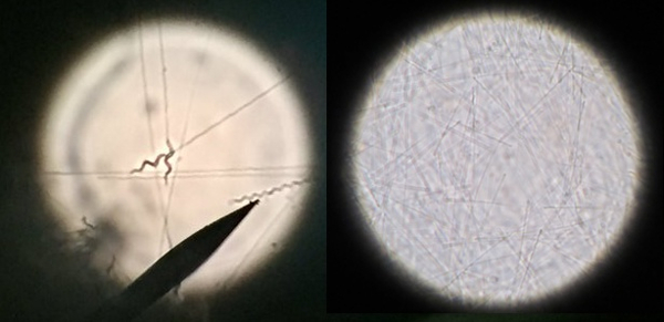 Microscope analysis of fungal hyphae; left: needle points for isolation; right: hyphae network.
