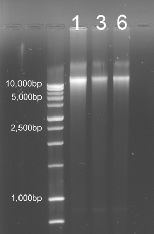 Gel electrophoresis result, DNA separation, bands at 10,000bp, 5,000bp, 2,500bp, and 1,000bp.