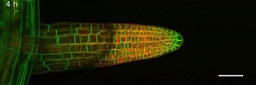 Fluorescence microscopy image of plant root cells showing growth patterns with cell walls highlighted.