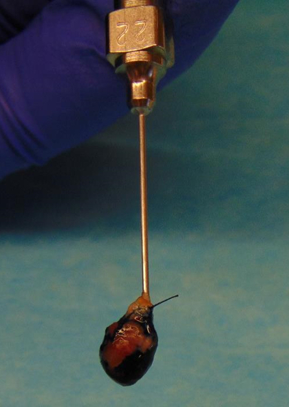 Tumor biopsy needle setup; tissue extraction process, close-up, medical research equipment.