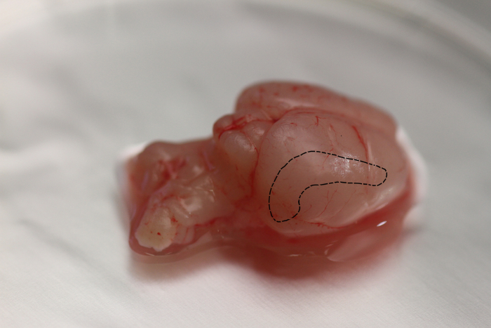Dissected brain diagram showing hippocampus, neuroscience study, anatomical research.