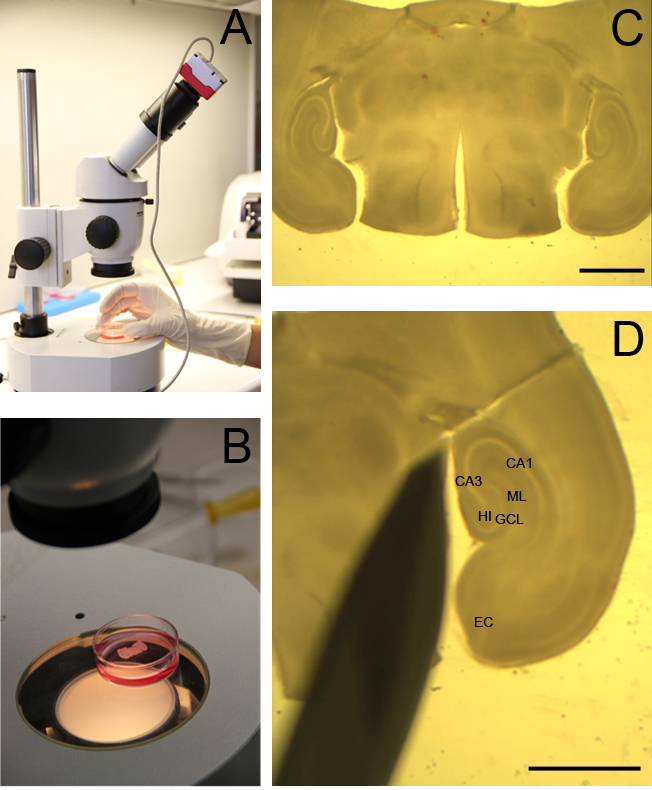 Microscopy sample preparation, brain tissue sectioning setup, anatomical analysis diagram, labeled regions.