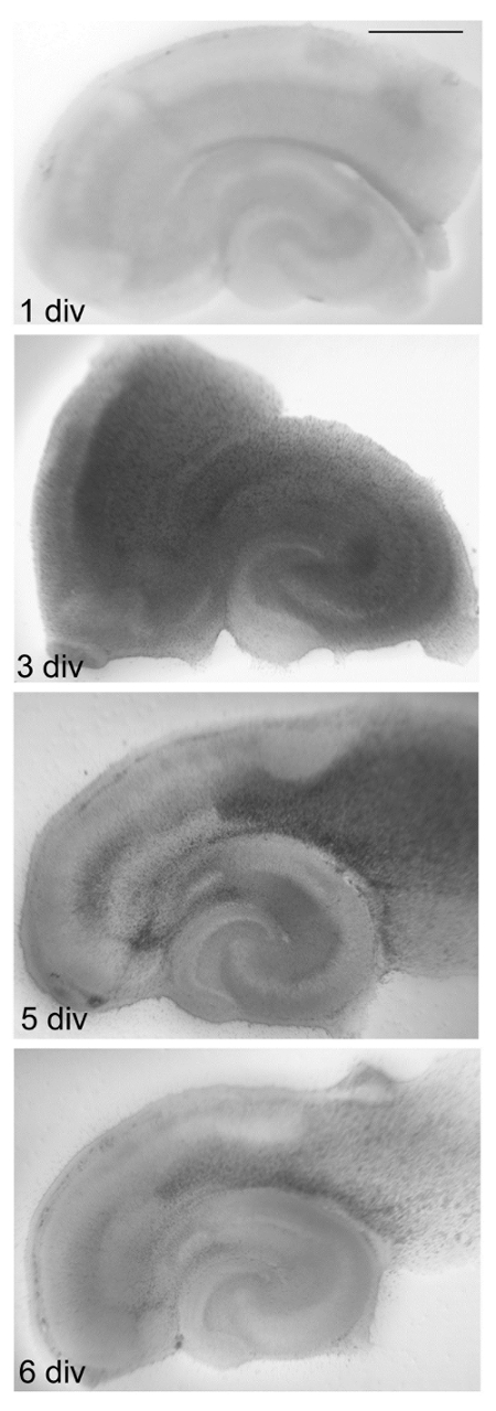 Neurodevelopment stages in vitro, microscopy image, 1-6 DIV brain tissue culture analysis.