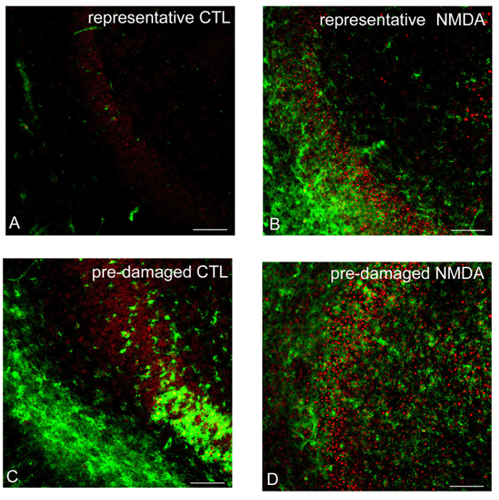 Immunofluorescence analysis, control vs. NMDA, highlighting cellular damage, microscopy images.
