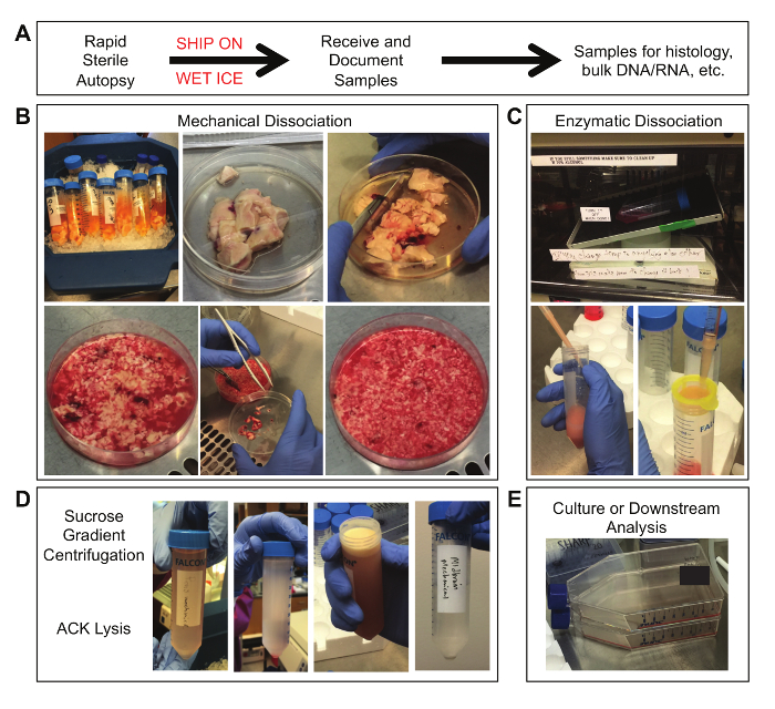 figure-results-1 Autopsy sample processing; mechanical, enzymatic dissociation; centrifugation; cell culture analysis.
