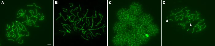Fluorescent microscopy images of chromosomal structures, highlighting different DNA conformations.