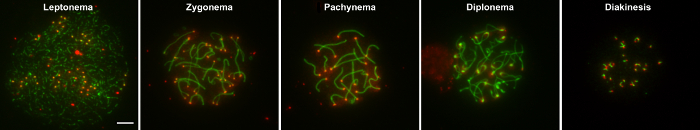 Meiotic prophase I stages: Leptonema, Zygonema, Pachynema, Diplonema, Diakinesis; fluorescence microscopy.