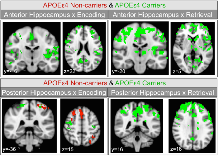 Brain imaging; anterior/posterior hippocampus activation; APOE4 carriers vs non-carriers; fMRI results.