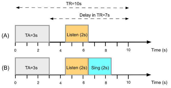 Timing sequence diagram; TR=10s; tasks: listening, singing displayed along time axis.