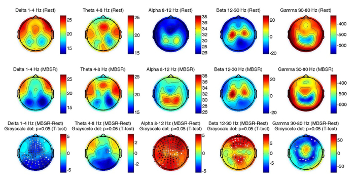 figure-results-1 EEG frequency maps, 1-80 Hz, comparative brain activity diagram, mindfulness experiment results.