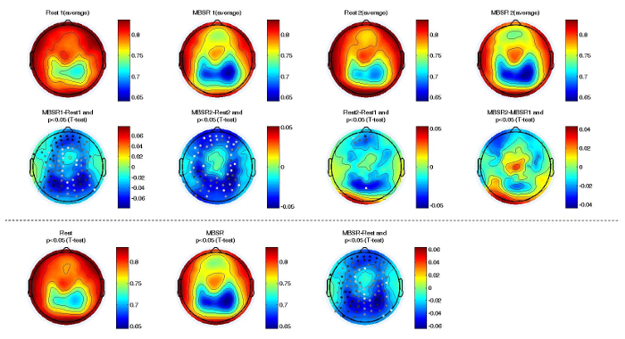 figure-results-3 Brain activity heatmap; statistical t-test comparison; topographic EEG data visualization.
