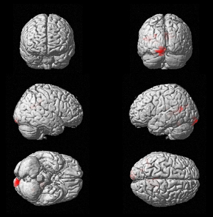 figure-results-4 Brain activity in fMRI scans showing highlighted regions; neuroscience, cognitive function analysis.