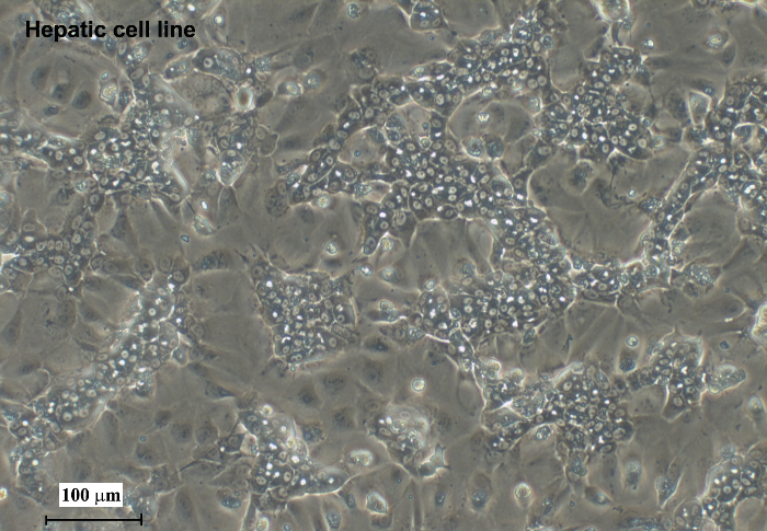 figure-protocol-2 Hepatic cell line microscope image, cellular morphology study, microscopic analysis, 100 μm scale.