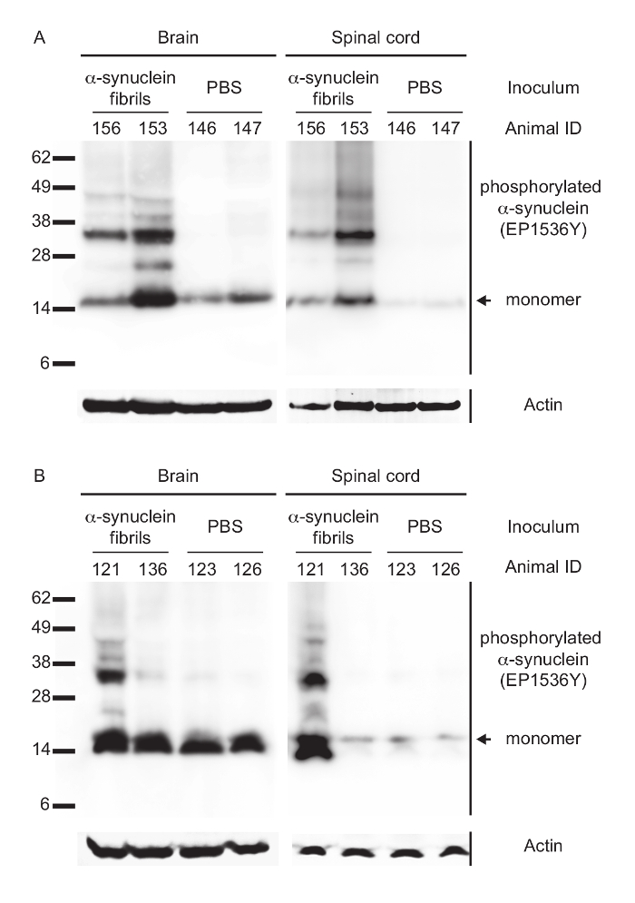 figure-results-2 Western blot diagram; phosphorylated α-synuclein detection in brain, spinal cord; protein analysis.