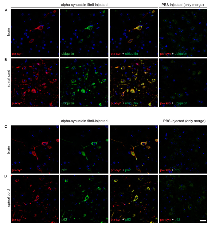 figure-results-3 Immunofluorescence; alpha-synuclein fibrils vs PBS injection in brain, spinal cord; p62, ubiquitin levels.