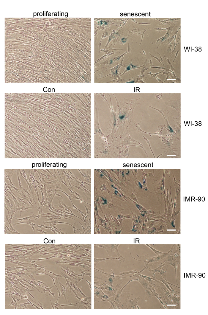 Cell senescence vs proliferation: WI-38, IMR-90, stained microscopy images, IR treatment comparison.