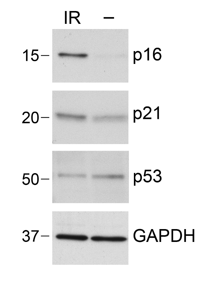 Western blot analysis, protein expression of p16, p21, p53, GAPDH; IR treatment result.