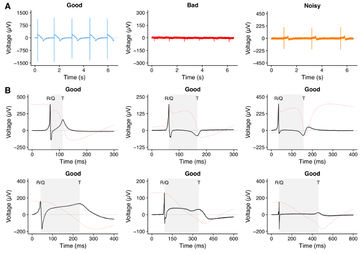 figure-results-4 Voltage analysis graphs; Time vs Voltage; signal quality comparison; data integrity assessment.