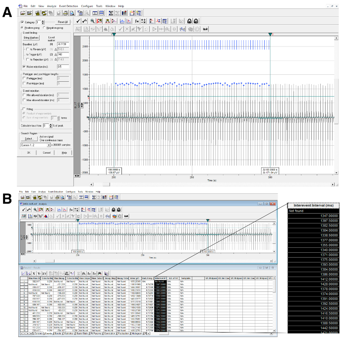 figure-results-5 Cardiac electrophysiology analysis showing waveforms and inter-event intervals; data visualization graph.