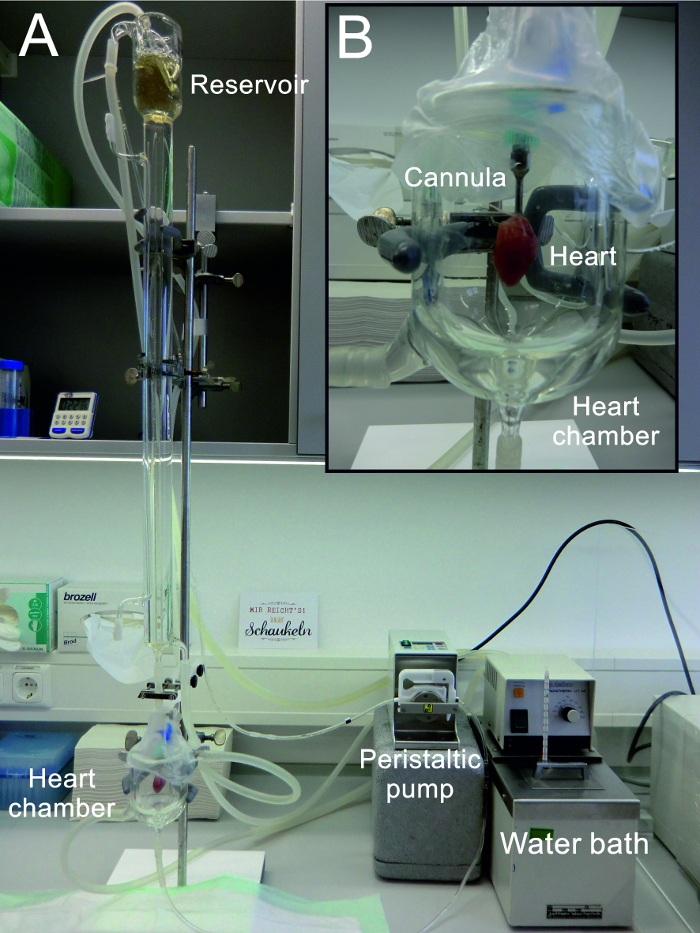 figure-results-1 Langendorff heart perfusion: Heart cannulation, peristaltic pump, reservoir, water bath in lab setup.