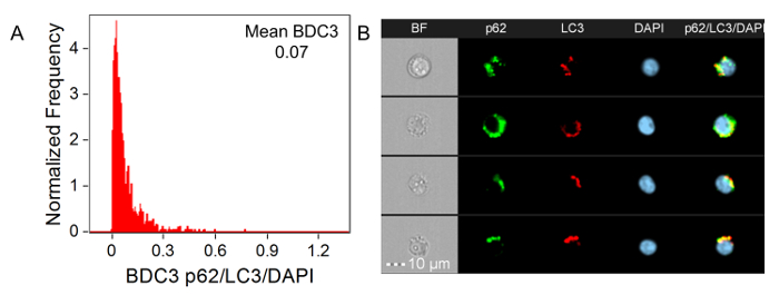 figure-results-6 Autophagy marker analysis; graph of BDC3 p62/LC3/DAPI ratio, microscopy images with fluorescence.