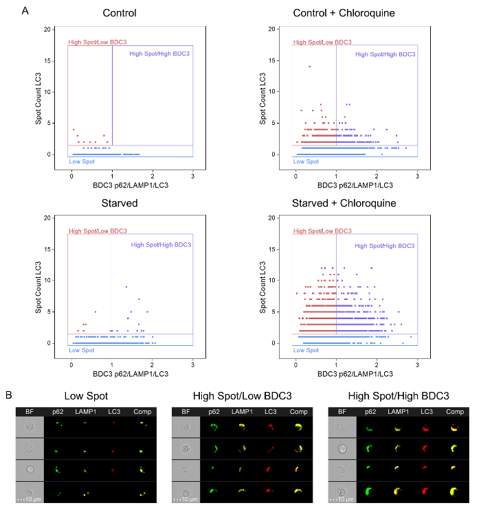 figure-results-7 Cellular autophagy data; scatter plots; LC3 spot count; BDC3 and p62/LAMP1/LC3 analysis.