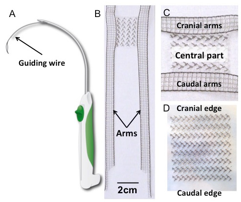 Guiding wire setup and stent design diagram; shows cranial, caudal parts for surgical application.