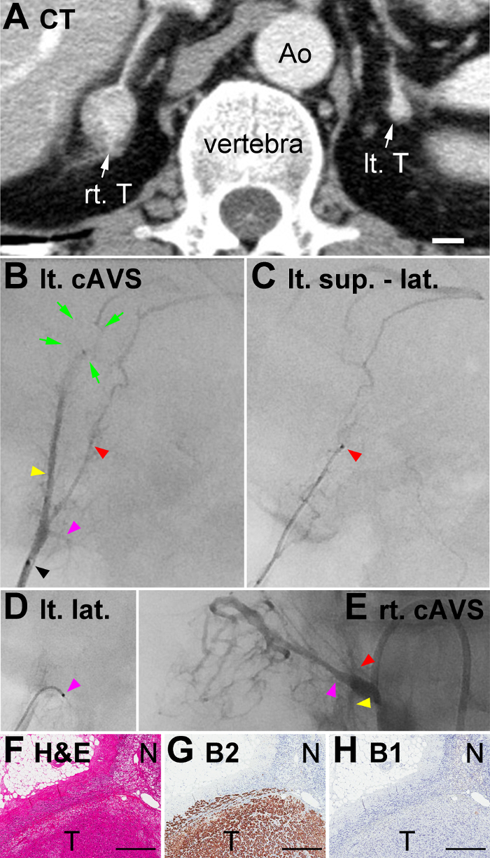CT anatomy and vascular imaging; diagrams of vertebra and arterial structure; histology slides.