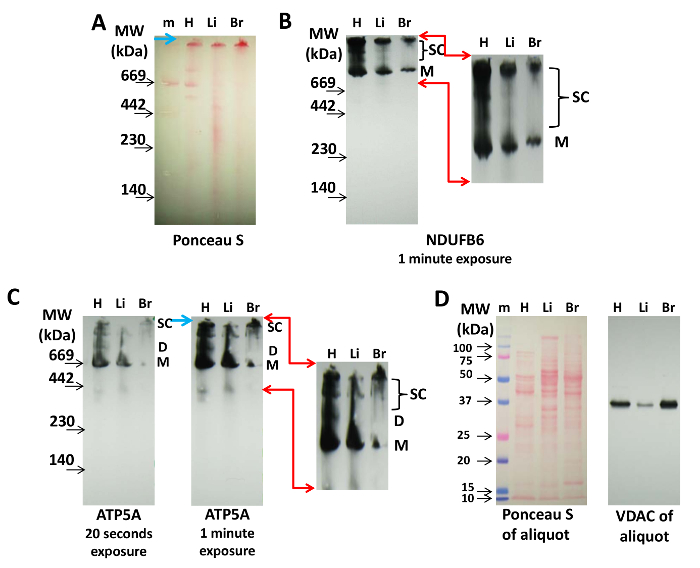 Electrophoresis results, Ponceau S stain, NDUFB6, ATP5A, VDAC, protein size, kDa markers, H, Li, Br.