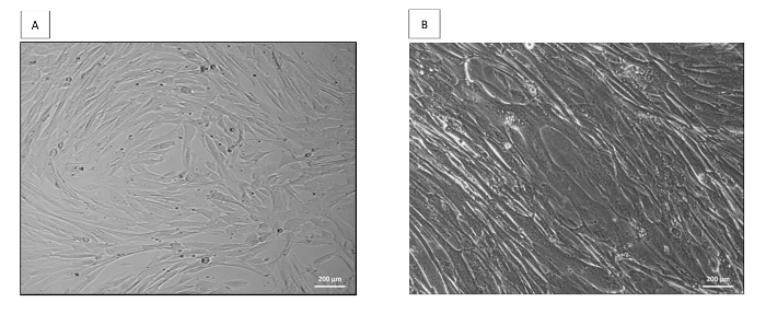 Cell culture microscope images showing fibroblast growth patterns; visual comparison of morphology.