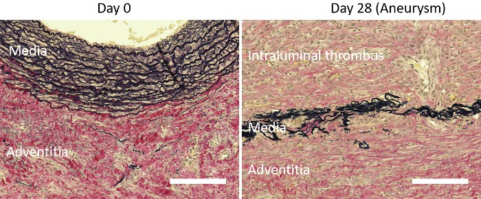 Histological comparison diagram: aneurysm development, media, adventitia, thrombus, day 0 vs. day 28.