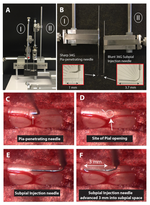 Subpial injection procedure, diagram; sharp 34G needle, blunt 36G needle, pial opening site.