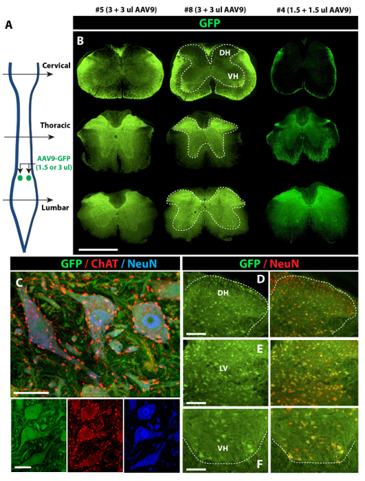 AAV9-GFP fluorescence in spinal cord sections; diagram of injection sites; nerve cell markers.