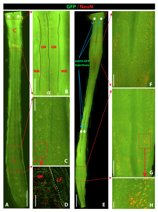 GFP/NeuN microscopy image of spinal cord sections, showing AAV9-GFP injections and neuronal labeling.