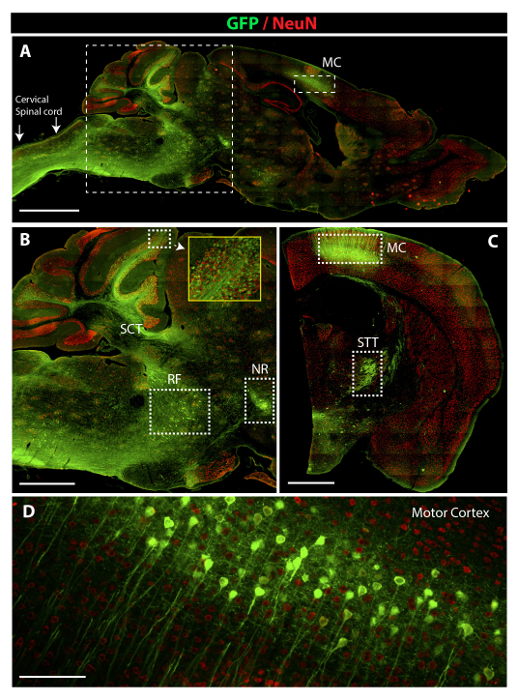 GFP/NeuN brain sections; fluorescence microscopy; cellular distribution; motor cortex analysis.