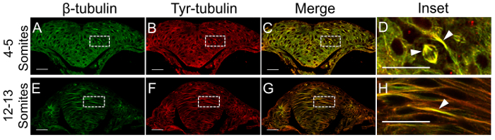 Immunofluorescence of embryonic somites, β-tubulin, Tyr-tubulin, merged images; microscopy results.