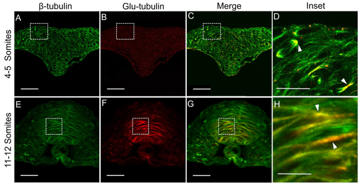 β-tubulin and Glu-tubulin in somites, fluorescence microscopy showing protein localization diagrams.
