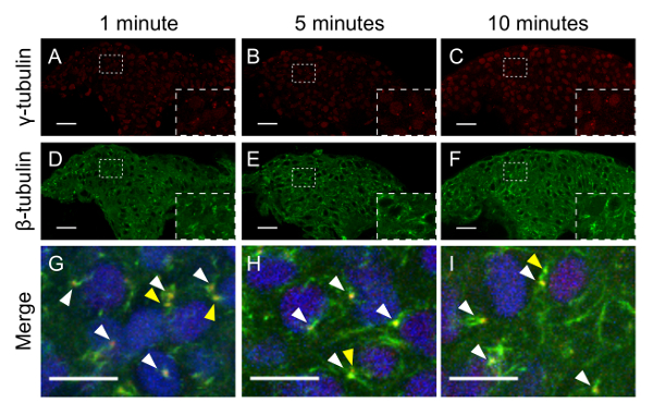 Fluorescence microscopy diagram showing γ-tubulin, β-tubulin protein localization over time.