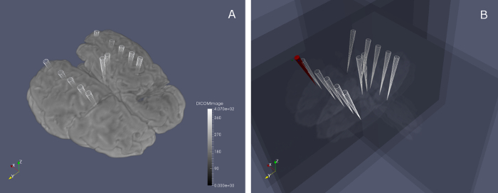 Brain imaging electrodes; 3D diagram; neuroimaging; probe insertion depth; data visualization.