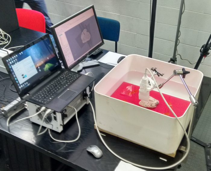 Ultrasound imaging setup; computer analysis; 3D modeling; water tank; medical research.