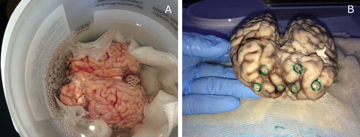 Preserved human brains in formaldehyde, comparative study of anatomical features, neuroscience image.